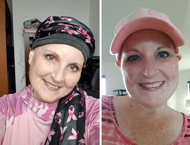 Lori during cancer treatment